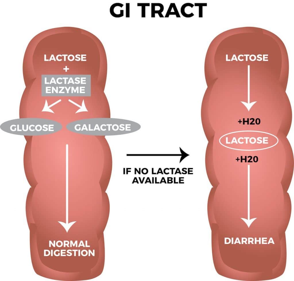 GI Tract describing lactose intolerance