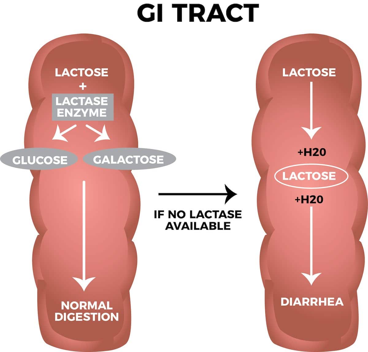 Lactose Intolerance Symptoms, Causes, and Treatment Switch4Good